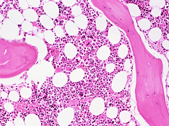 Microscopic image of bone marrow with pink and white hues